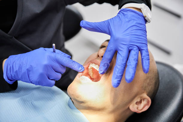 Best Root Canal Emergency Dentist  in Valley Forge, TN